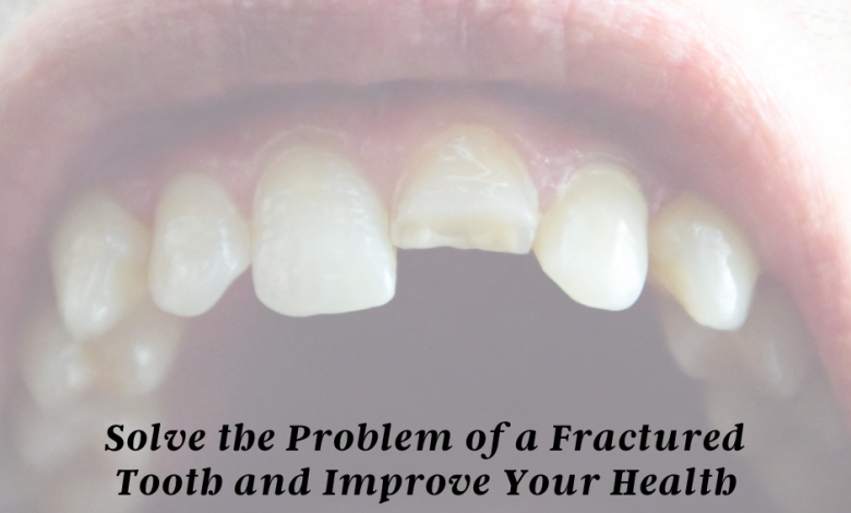 Fractured Tooth